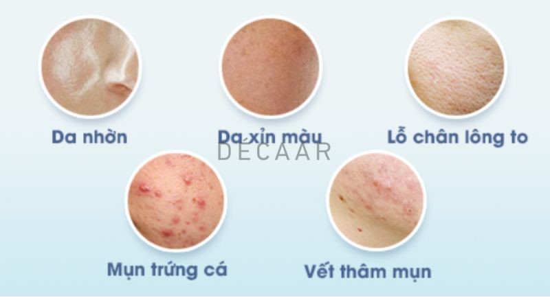Đối tượng nên peel da
